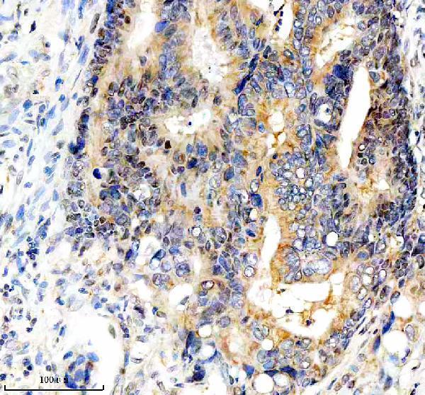  IHC analysis of FBXO7 using anti-FBXO7 antibody (A04086-2)