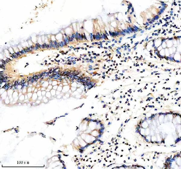  IHC analysis of FBXO7 using anti-FBXO7 antibody (A04086-2)