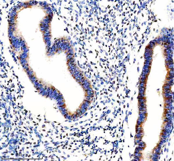 a04086 2 fbxo7 primary antibodies ihc testing 4