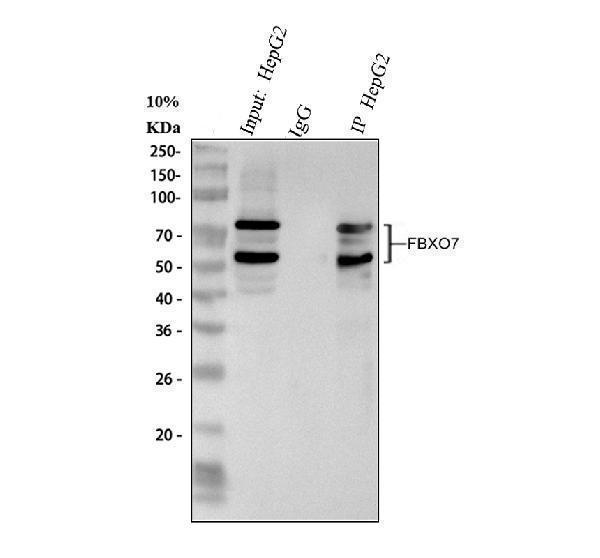 a04086 2 fbxo7 primary antibodies ip testing 6