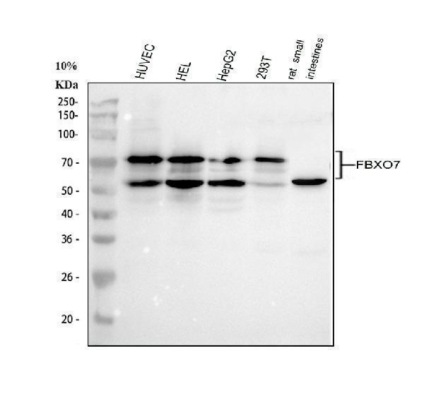  Western blot analysis of FBXO7 using anti-FBXO7 antibody (A04086-2)