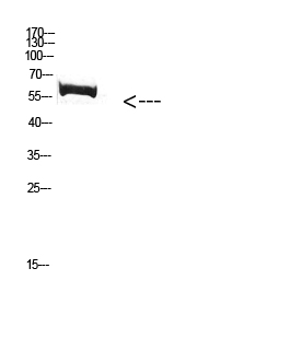 Western Blot analysis of mouse-kidney cells using Antibody diluted at 1000