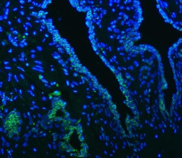 a04087 2 slc22a8 primary antibodies if testing 6