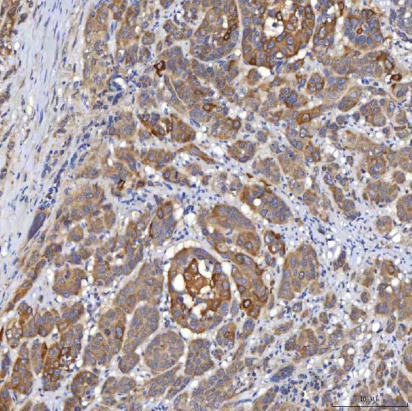 a04087 2 slc22a8 primary antibodies ihc testing 5