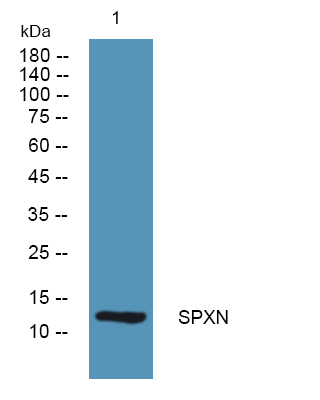 Western blot analysis of lysates from SH-SY5Y cells, primary antibody was diluted at 1:1000, 4°over night