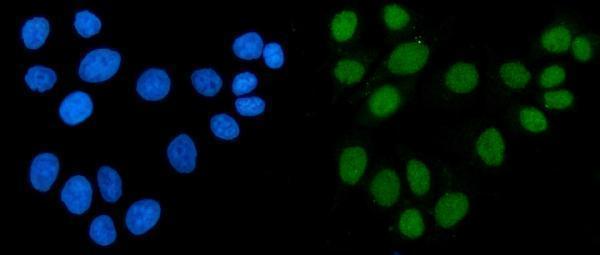  IF analysis of ACF1/BAZ1A using anti-ACF1/BAZ1A antibody (A04090-1)