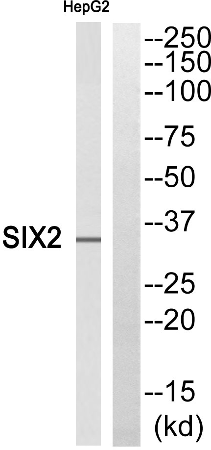 Western blot analysis of SIX2 Antibody