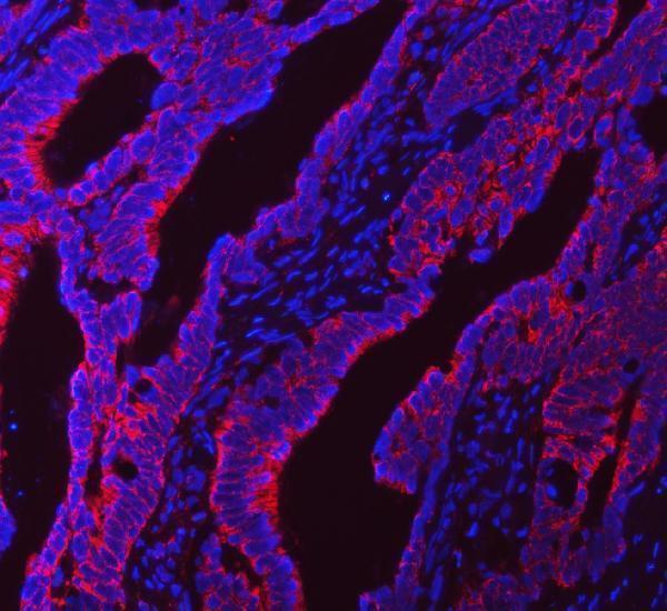 a04093 1 ndufs5 primary antibodies if testing 7