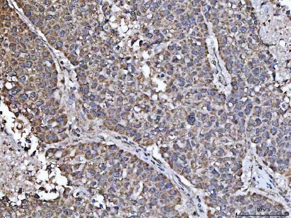  IHC analysis of NDUFS5 using anti-NDUFS5 antibody (A04093-1)