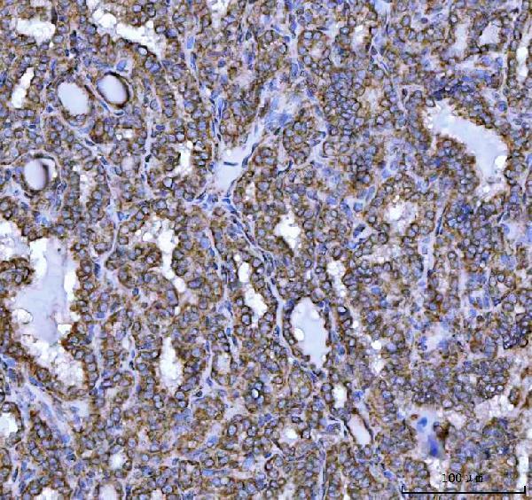  IHC analysis of NDUFS5 using anti-NDUFS5 antibody (A04093-1)
