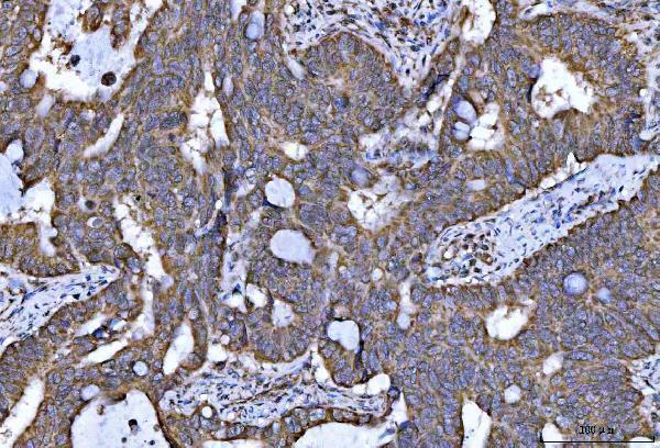 a04093 1 ndufs5 primary antibodies ihc testing 4_1