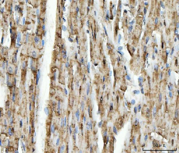 a04093 1 ndufs5 primary antibodies ihc testing 6