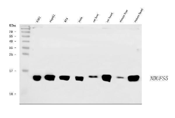  Western blot analysis of NDUFS5 using anti-NDUFS5 antibody (A04093-1)