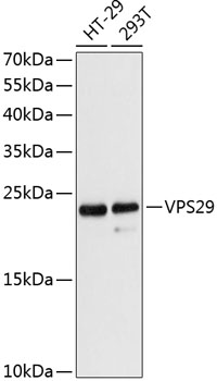 Western blot analysis of extracts of various cell lines, using VPS29 antibody  at 1:3000 dilution