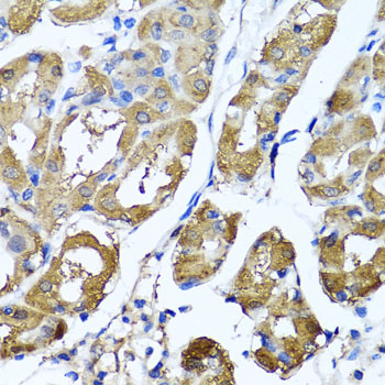 Immunohistochemistry of paraffin-embedded human stomach using HYAL1 antibody  at dilution of 1:100 