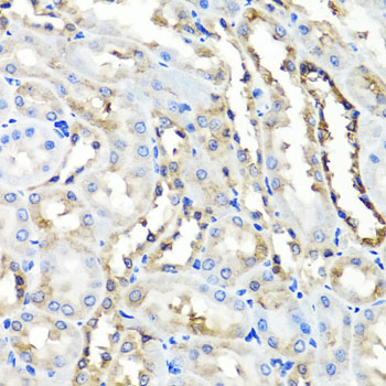 Immunohistochemistry of paraffin-embedded rat kidney using HYAL1 antibody  at dilution of 1:100 