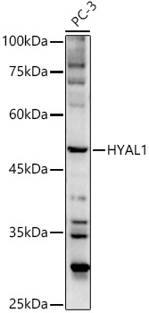 Western blot analysis of extracts of PC-3 cells, using HYAL1 antibody  at 1:500 dilution