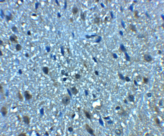 a04100 1 bclaf1 primary antibodies ihc testing 2