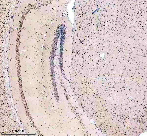 a04100 3 bclaf1 primary antibodies ihc testing 1