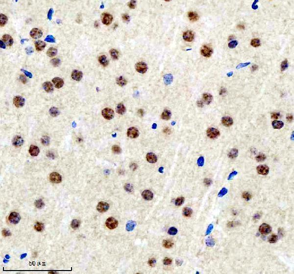 a04100 3 bclaf1 primary antibodies ihc testing 2