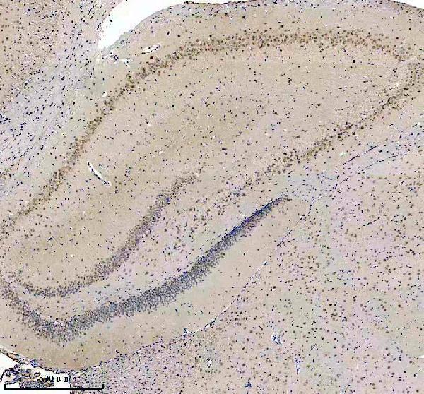 a04100 3 bclaf1 primary antibodies ihc testing 3