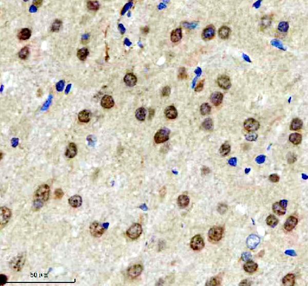 a04100 3 bclaf1 primary antibodies ihc testing 4
