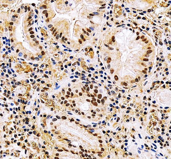 a04100 3 bclaf1 primary antibodies ihc testing 5