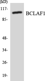 Western blot analysis of the lysates from HeLa cells using BCLAF1 antibody
