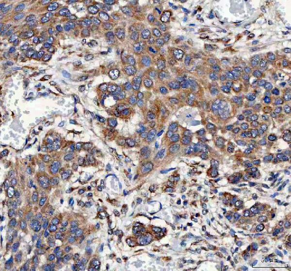  IHC analysis of Mitofilin/IMMT using anti-Mitofilin/IMMT antibody (A04102-2)