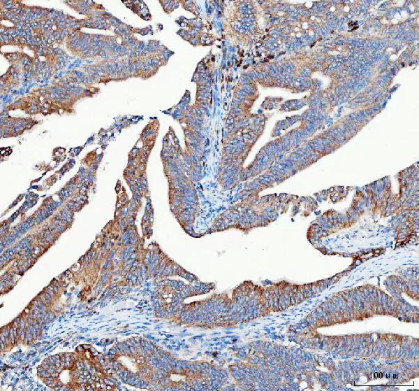  IHC analysis of Mitofilin/IMMT using anti-Mitofilin/IMMT antibody (A04102-2)