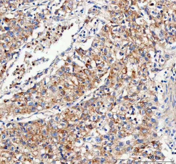 a04102 2 immt primary antibodies ihc testing 4