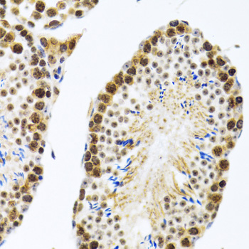 a04103 cirbp primary antiboties ihc testing 3