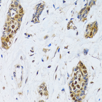 a04103 cirbp primary antiboties ihc testing 4