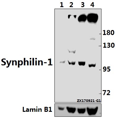 a04107 sncaip primary antiboties wb testing 1
