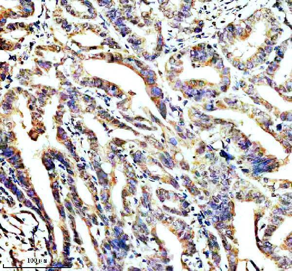 IHC analysis of STOML2 using anti-STOML2 antibody (A04108-1)