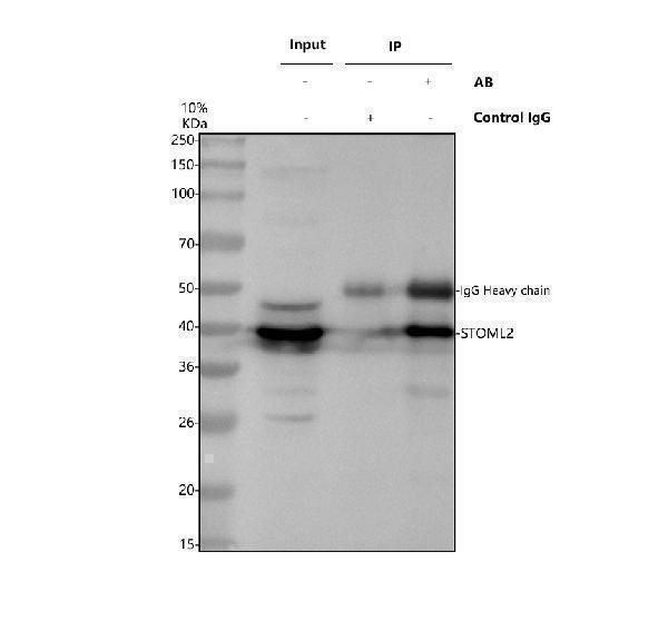 Immunoprecipitating STOML2 in jurkat whole cell lysate