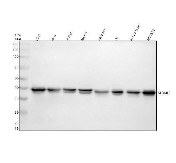 Western blot analysis of STOML2 using anti-STOML2 antibody (A04108-1)