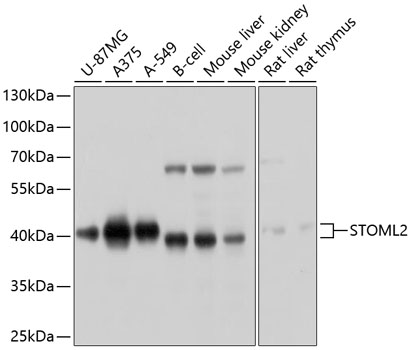 Western blot analysis of extracts of various cell lines, using STOML2 antibody  at 1:1000 dilution