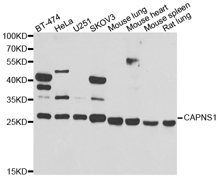 a04111 capns1 primary antiboties wb testing 1