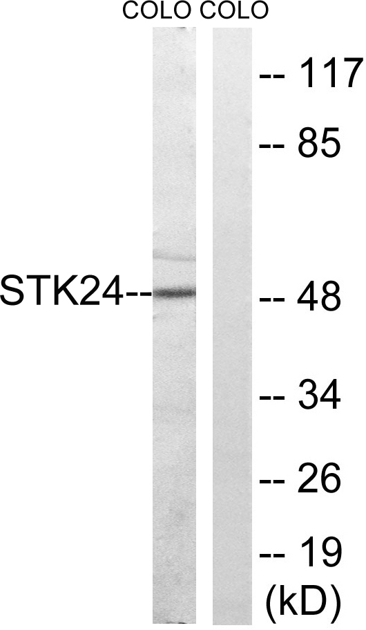 Western blot analysis of lysates from COLO cells, using STK24 Antibody