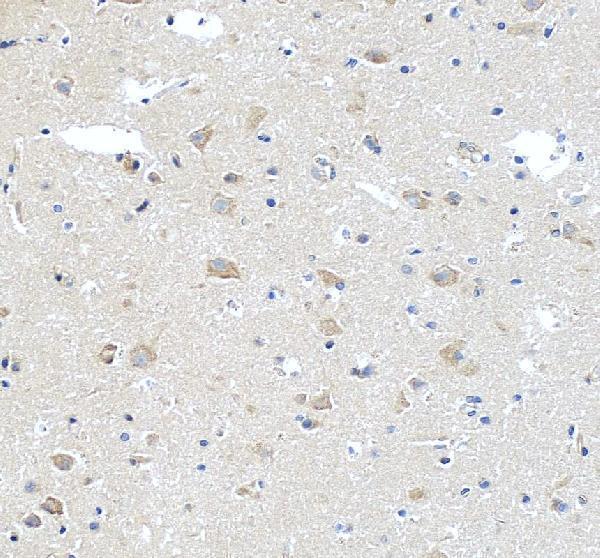IHC analysis of STK24 using anti-STK24 antibody (A04112-3)