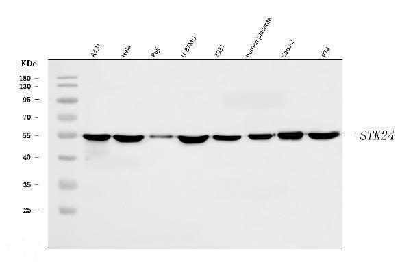  Western blot analysis of MST3/STK24 using anti-MST3/STK24 antibody (A04112-3)