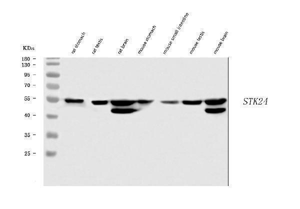  Western blot analysis of MST3/STK24 using anti-MST3/STK24 antibody (A04112-3)