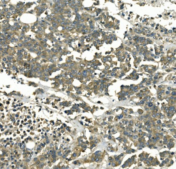  IHC analysis of Galectin 2/LGALS2 using anti-Galectin 2/LGALS2 antibody (A04114-2)