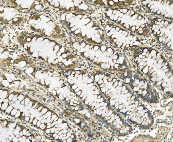  IHC analysis of Galectin 2/LGALS2 using anti-Galectin 2/LGALS2 antibody (A04114-2)
