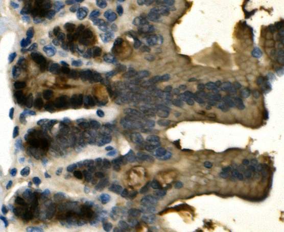 a04114 2 lgals2 primary antibodies ihc testing 4