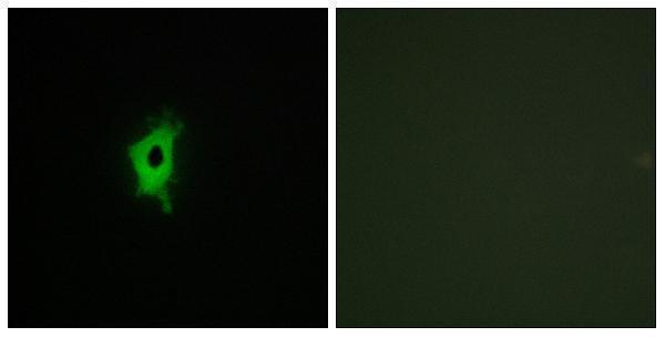 a04114 lgals2 primary antibodies if testing 1