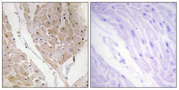a04114 lgals2 primary antibodies ihc testing 2