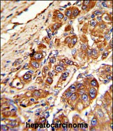 a04116 1 anti klc1 antibody center ihc p testing 2