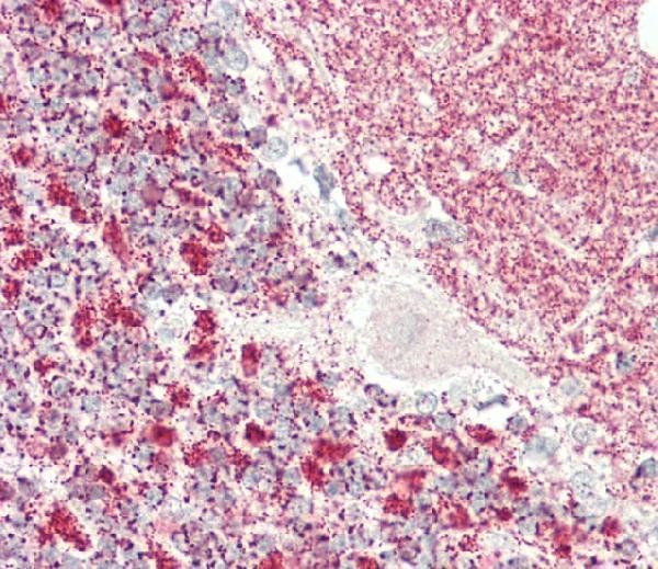 a04116 1 anti klc1 antibody center ihc p testing 3